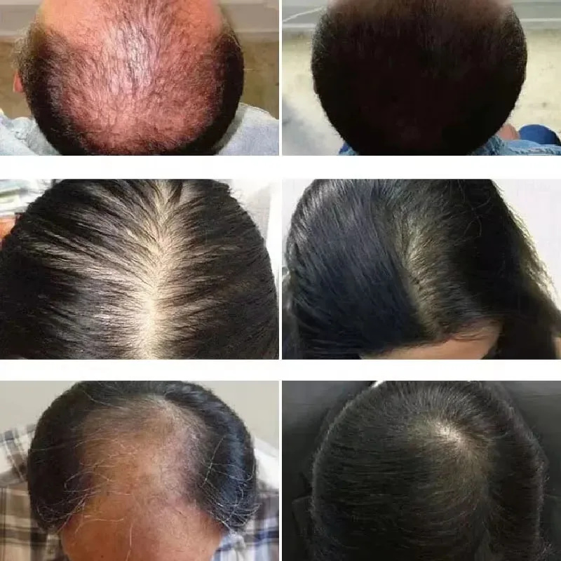 Rosemary Hair Growth Oil Anti  – Hair Care Ouai recenzja i cena