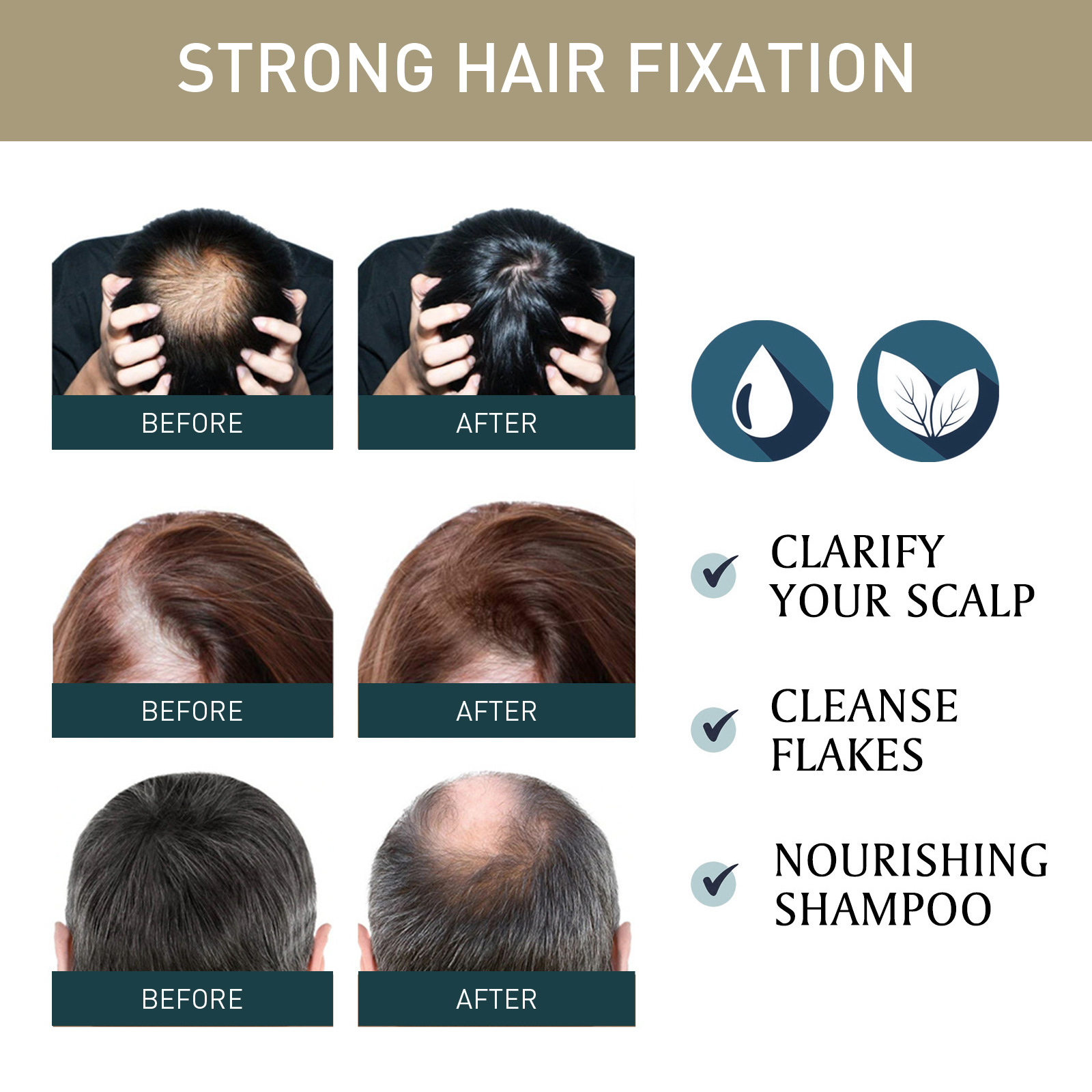 2pcsx100ml Hair Growth Shampoo – Hair Care Natural Ingredients recenzja i cena