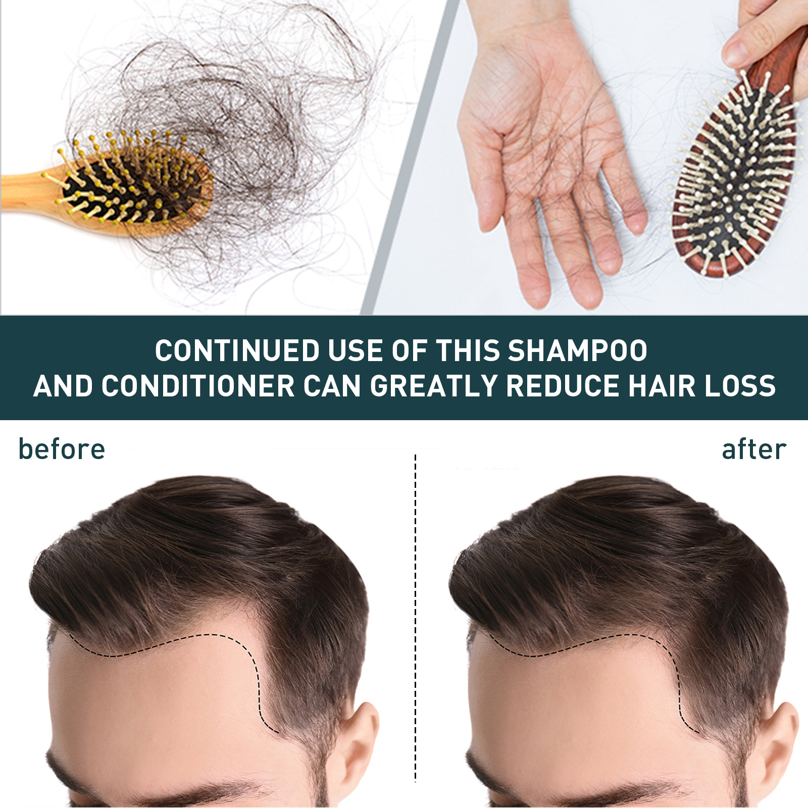 2pcsx100ml Hair Growth Shampoo – Hair Care Natural Ingredients recenzja i cena
