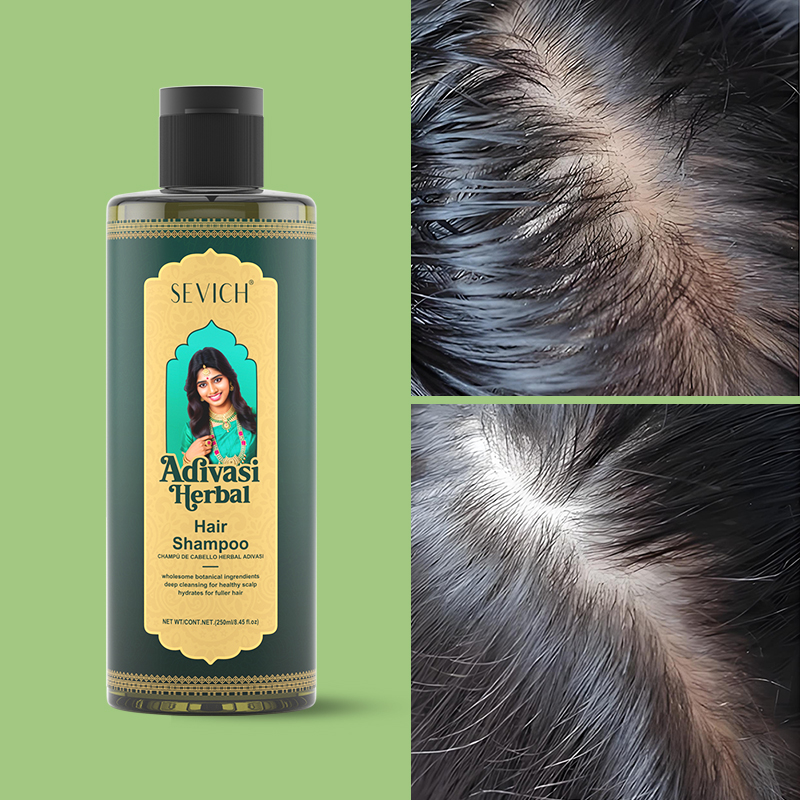 SEVICH Herbal Hair Growth Oil  – Hair Care India recenzja i cena
