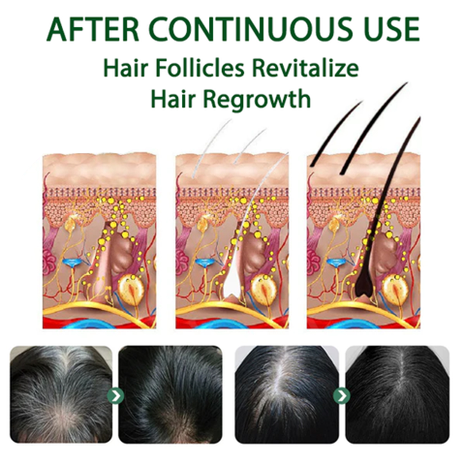 Eelhoe Black Hair Spray Promot – Hair Care Natural Ingredients recenzja i cena