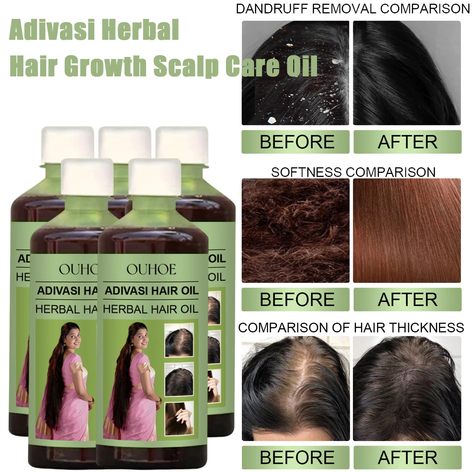 100ml Hair Growth Oil India Ad – Hair Care Ouai recenzja i cena