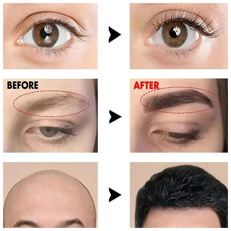 Fast Eyebrow Growth Serum Eyel – Hair Care Tonic recenzja i cena